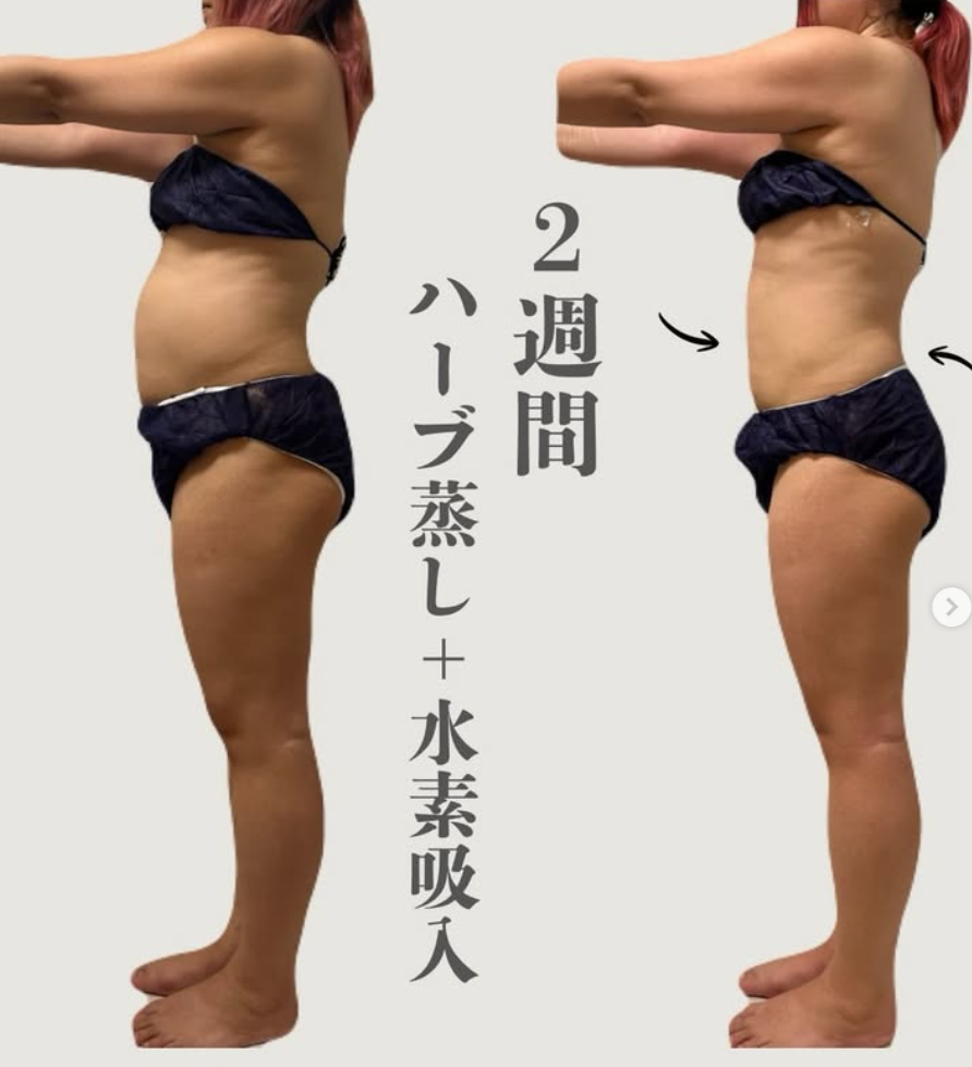提供された横姿の比較画像。画像内に2週間の記載あり